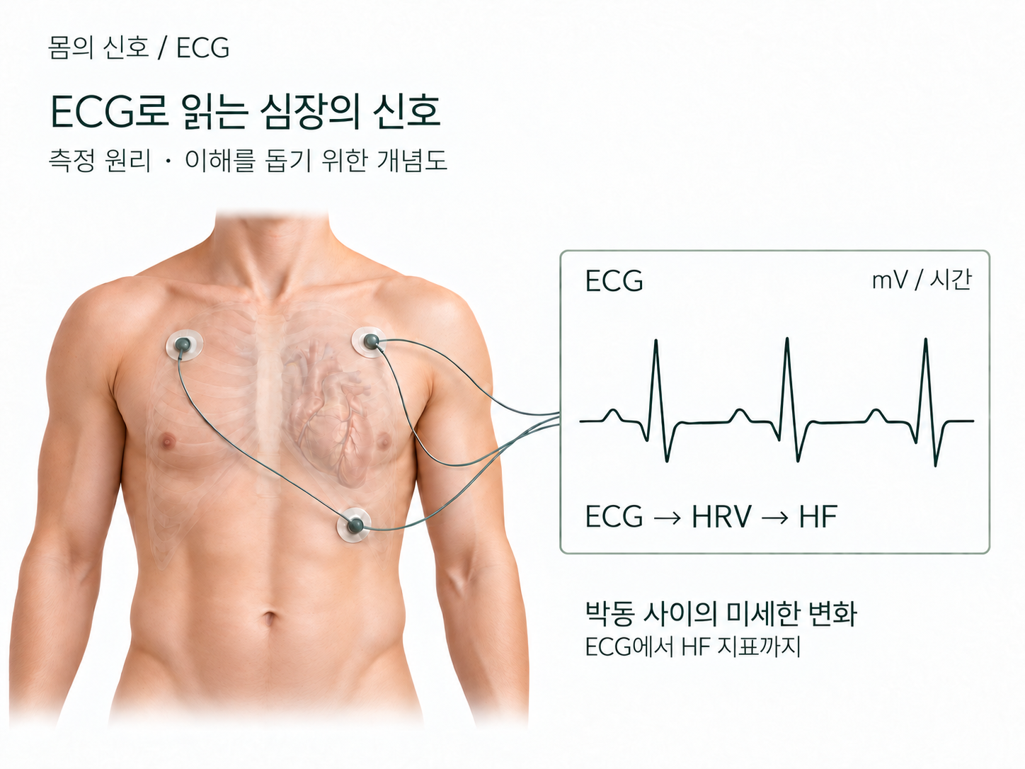 ECG 측정과 HF 지표의 관계를 보여주는 개념 일러스트