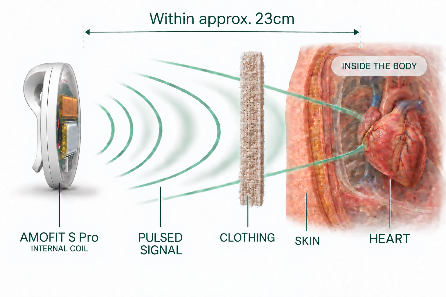 Pulsed magnetic field signals passing through clothing and skin toward the heart area, within approximately 23cm
