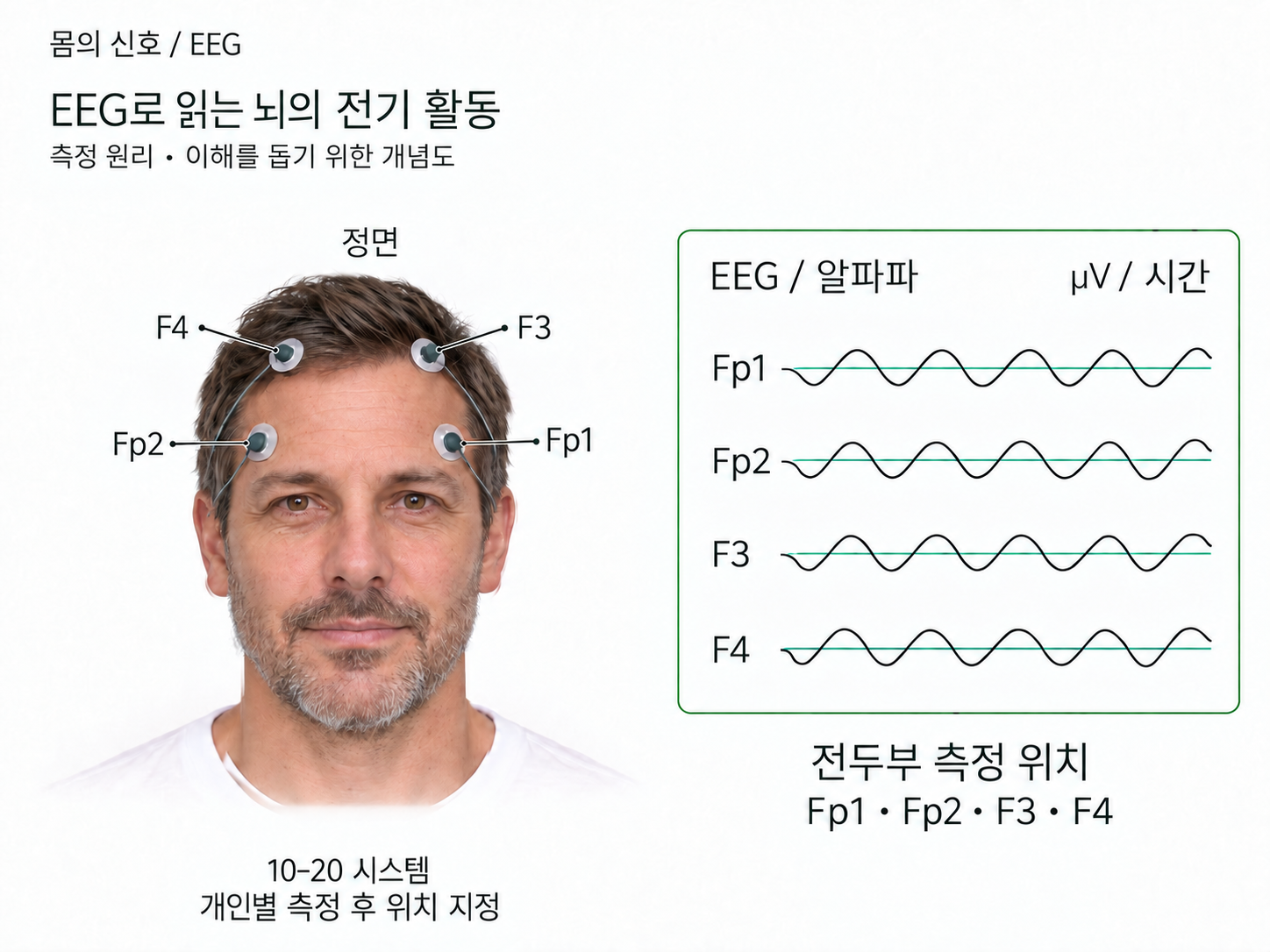 전두부 EEG 측정 위치와 뇌파를 보여주는 개념 일러스트