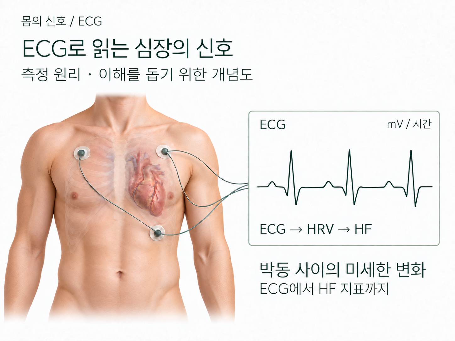 ECG 측정과 HF 지표의 관계를 보여주는 개념 일러스트