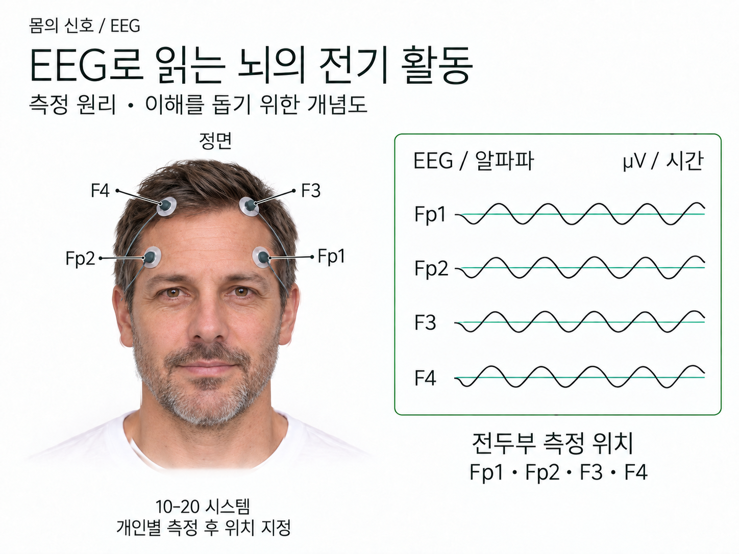 전두부 EEG 측정 위치와 뇌파를 보여주는 개념 일러스트